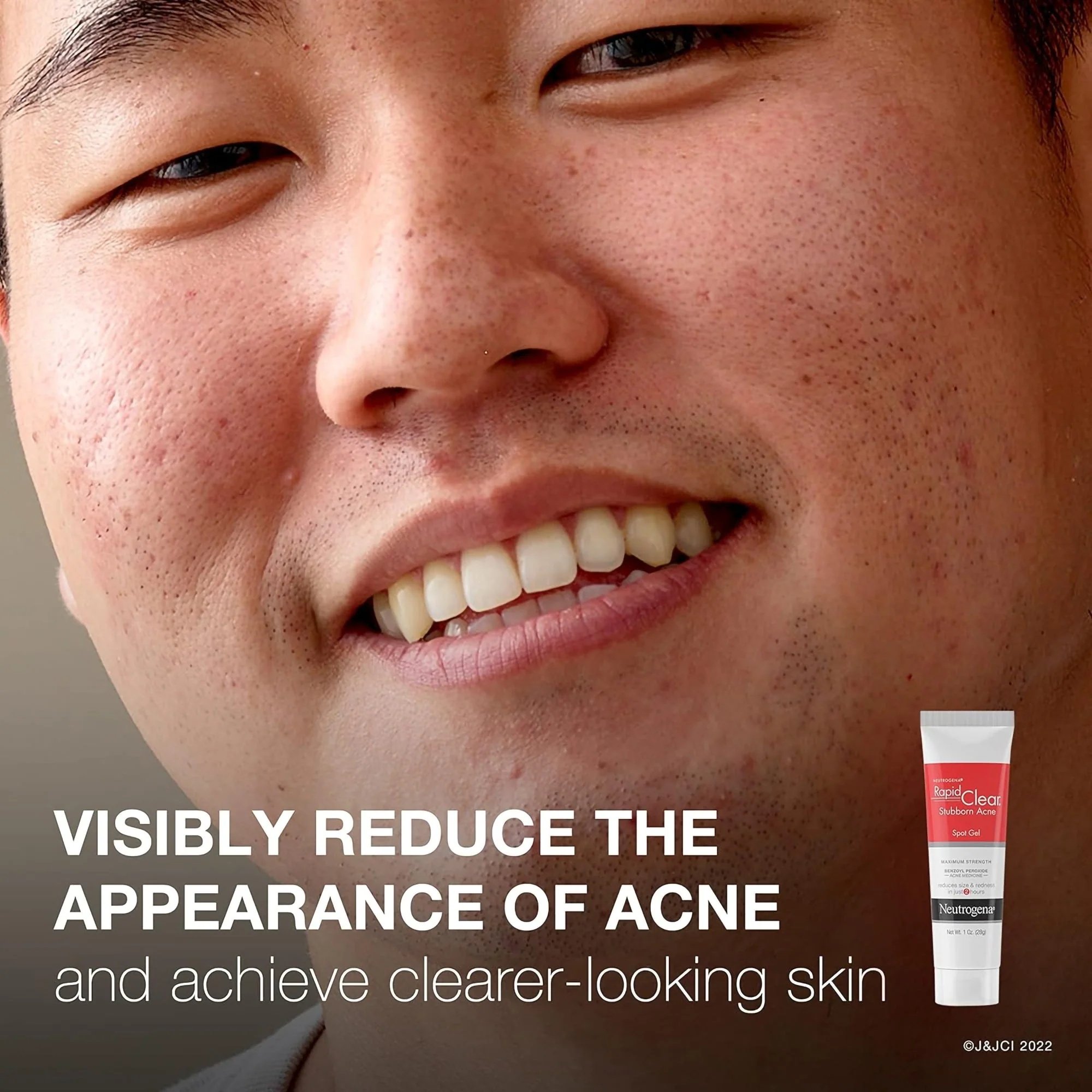 J & J Sales Neutrogena Rapid Clear Stubborn Acne Spot 10% Benzoyl Peroxide Gel, 1 ounce - Image 5