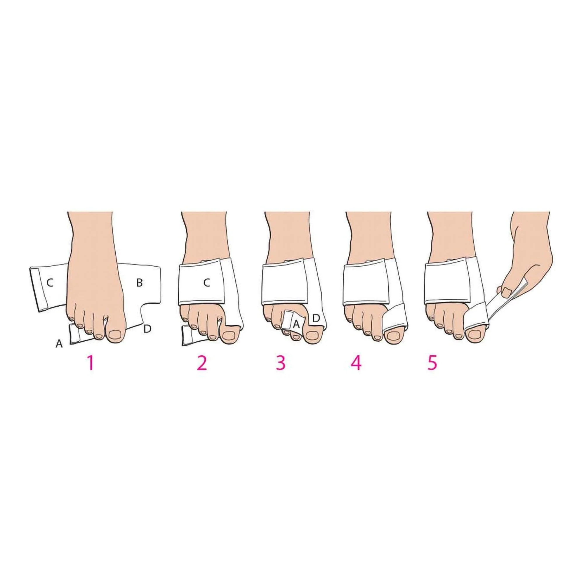 Pedifix Softsplint Bunion Splint for Left Foot, Medium - Image 3