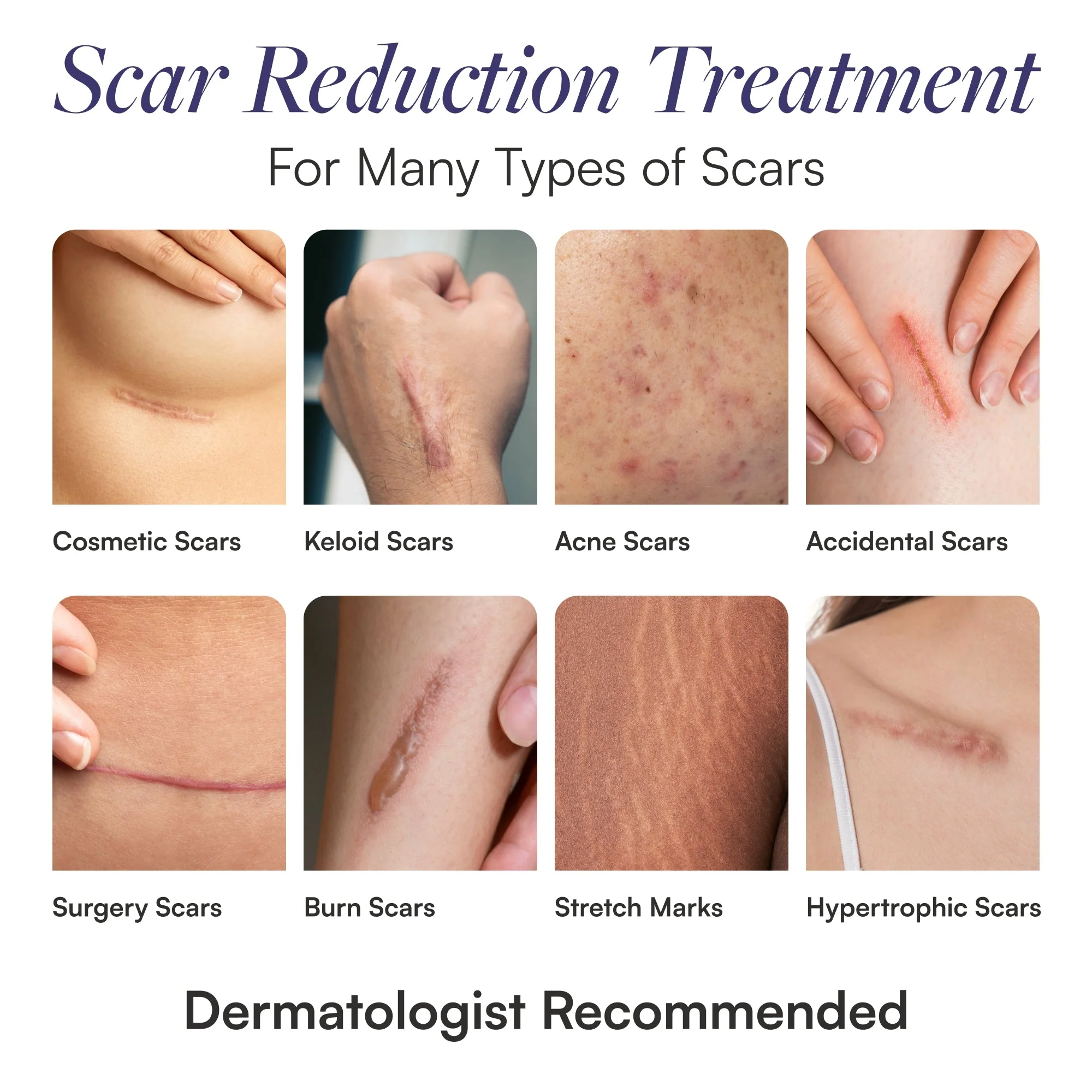 Skintensive LLC Skintensive Silicone Scar Gel (12/CS) - Image 5