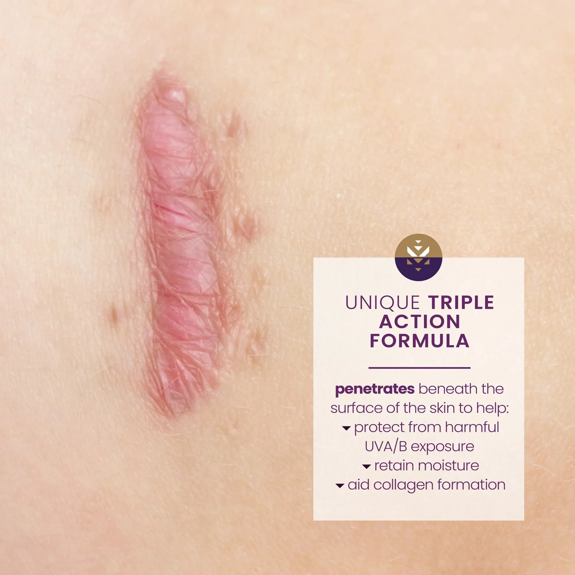 Emerson Healthcare Mederma Scar Cream Plus SPF 30 - Image 3