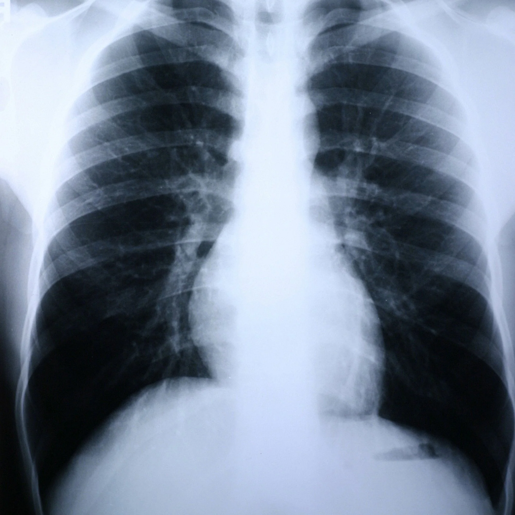 McKesson Brand Clear Choice Performance X-Ray Film (500/CS)