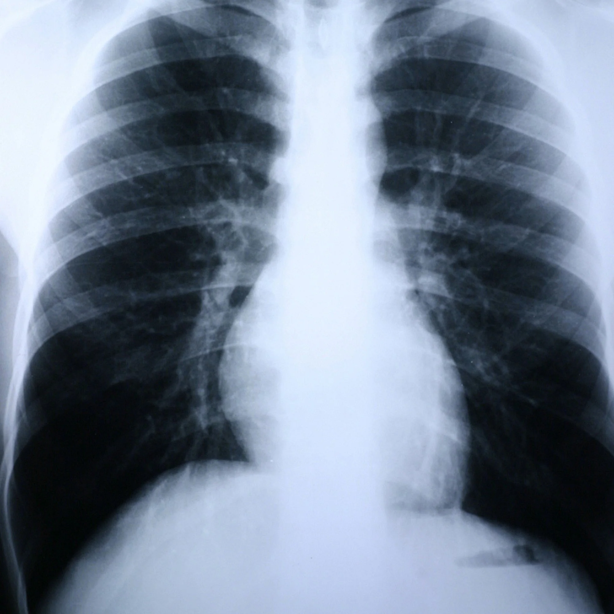 McKesson Brand Clear Choice Performance X-Ray Film (500/CS)