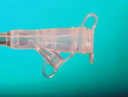 Y-Port Feeding Adapter AMT 20 Fr. For Capsule Dome G-Tube and Capsule Monarch G-Tube
